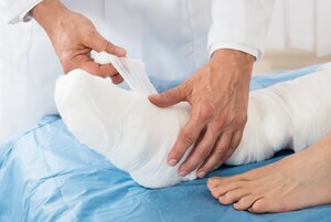 close-up der arzt hand binden bandage am bein patienten in der klinik